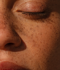 Close-up of freckled face with SPF 30 mineral sunscreen.